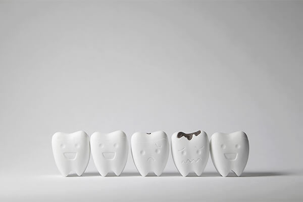 子供の虫歯予防について